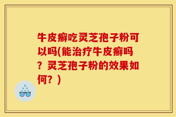 牛皮癣吃灵芝孢子粉可以吗(能牛皮癣吗?灵芝孢子粉的效果如何?) 牛皮癣吃灵芝孢子粉可以吗(能牛皮癣吗?灵芝孢子粉的效果如何?)