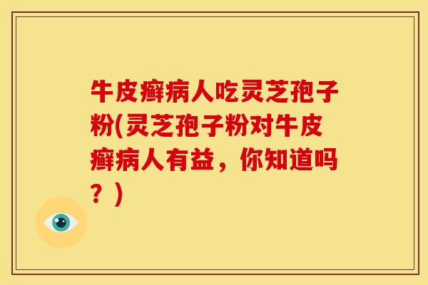牛皮癣人吃灵芝孢子粉(灵芝孢子粉对牛皮癣人有益,你知道吗?) 牛皮癣人吃灵芝孢子粉(灵芝孢子粉对牛皮癣人有益,你知道吗?)