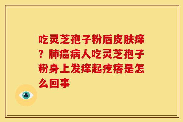 吃灵芝孢子粉后痒？人吃灵芝孢子粉身上发痒起疙瘩是怎么回事
