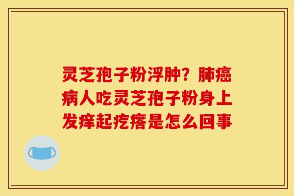灵芝孢子粉浮肿?人吃灵芝孢子粉身上发痒起疙瘩是怎么回事 灵芝孢子粉浮肿?人吃灵芝孢子粉身上发痒起疙瘩是怎么回事