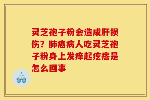 灵芝孢子粉会造成损伤？人吃灵芝孢子粉身上发痒起疙瘩是怎么回事