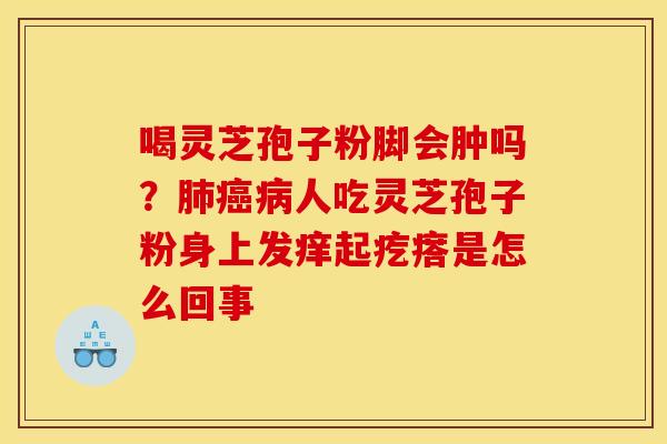 喝灵芝孢子粉脚会肿吗?人吃灵芝孢子粉身上发痒起疙瘩是怎么回事 喝灵芝孢子粉脚会肿吗?人吃灵芝孢子粉身上发痒起疙瘩是怎么回事