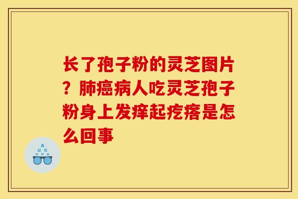 长了孢子粉的灵芝图片?人吃灵芝孢子粉身上发痒起疙瘩是怎么回事 长了孢子粉的灵芝图片?人吃灵芝孢子粉身上发痒起疙瘩是怎么回事