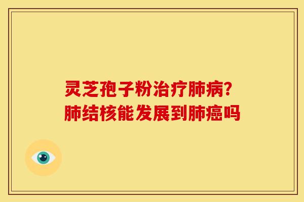 灵芝孢子粉?结核能发展到吗 灵芝孢子粉?结核能发展到吗