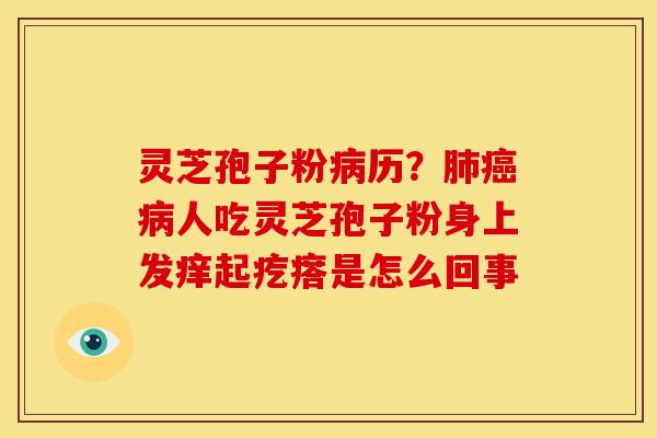 灵芝孢子粉历?人吃灵芝孢子粉身上发痒起疙瘩是怎么回事 灵芝孢子粉历?人吃灵芝孢子粉身上发痒起疙瘩是怎么回事