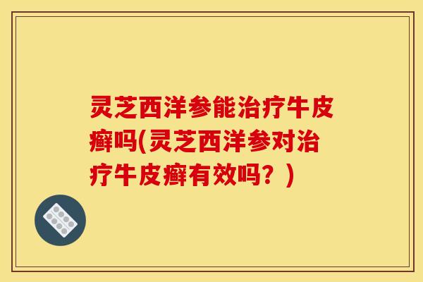灵芝西洋参能牛皮癣吗(灵芝西洋参对牛皮癣有效吗？)
